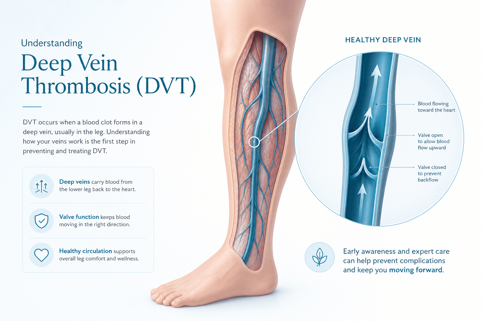 Medical illustration of deep vein thrombosis in the leg, vein specialist New York